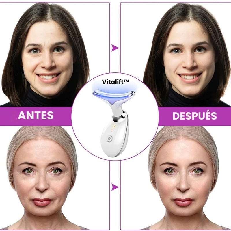 Masajeador Facial Anti Papada con Luz LED! 🌟 MercadoWeb