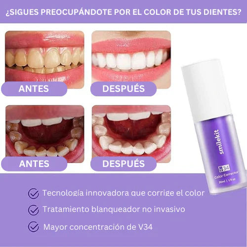 Ultra Blanqueamiento Dental 🦷 MercadoWeb
