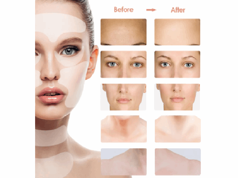 ⚡32%OFF⚡Beauty Parche Anti Arrugas Reafirmante MercadoWeb